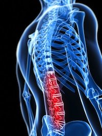 spinal cord injuries