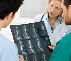 doctor looking at spinal cord x ray