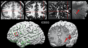 Diagnostic Testing For Traumatic Brain Injury