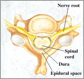 Posterior Longitudinal Ligament 