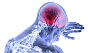 new york traumatic brain injury lawyer