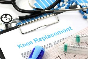 sue-exactech-knee-replacement