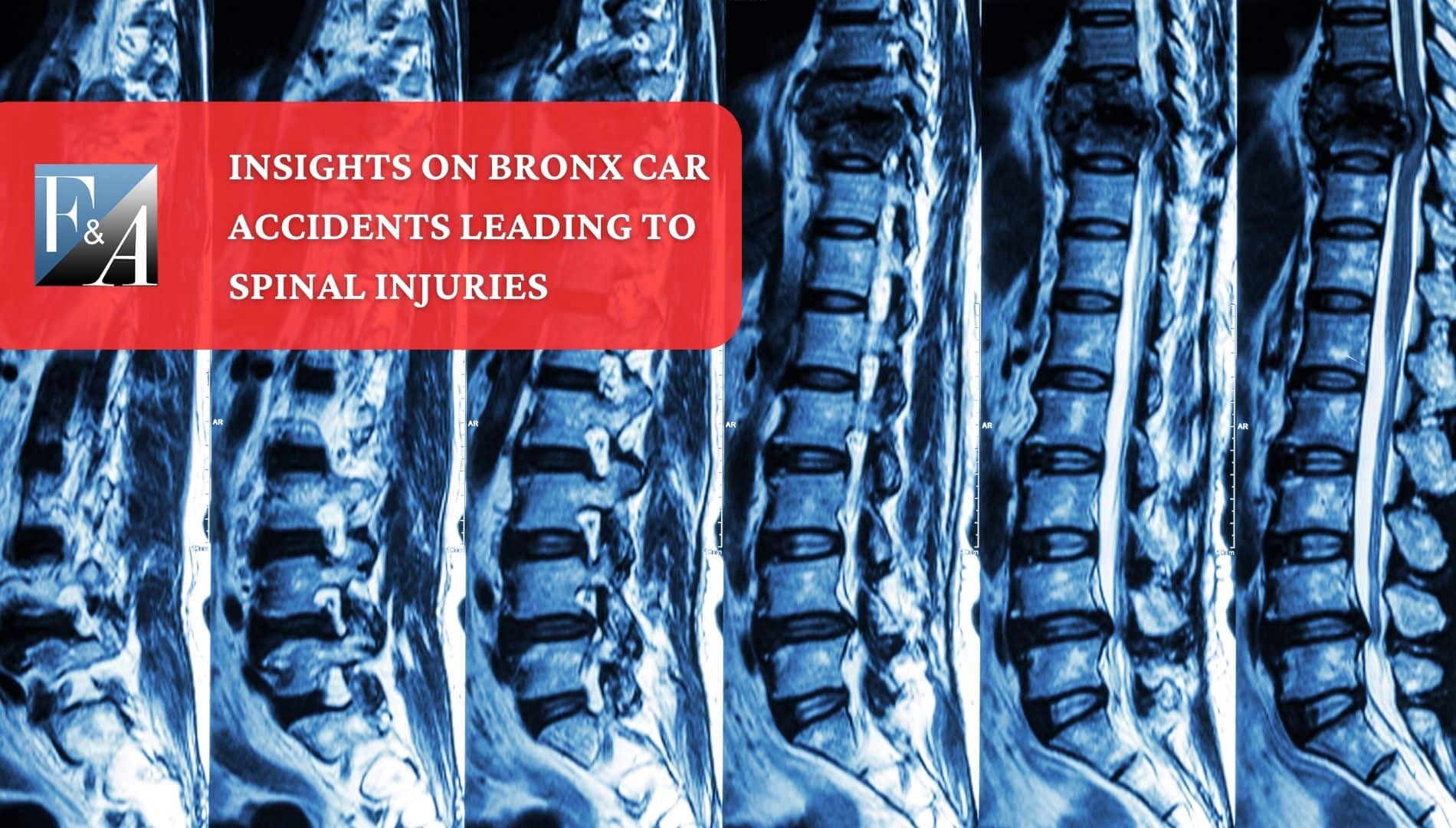 bronx-spinal-cord-injuries