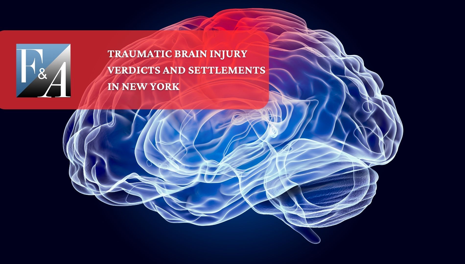 traumatic brain injury lawyer new york