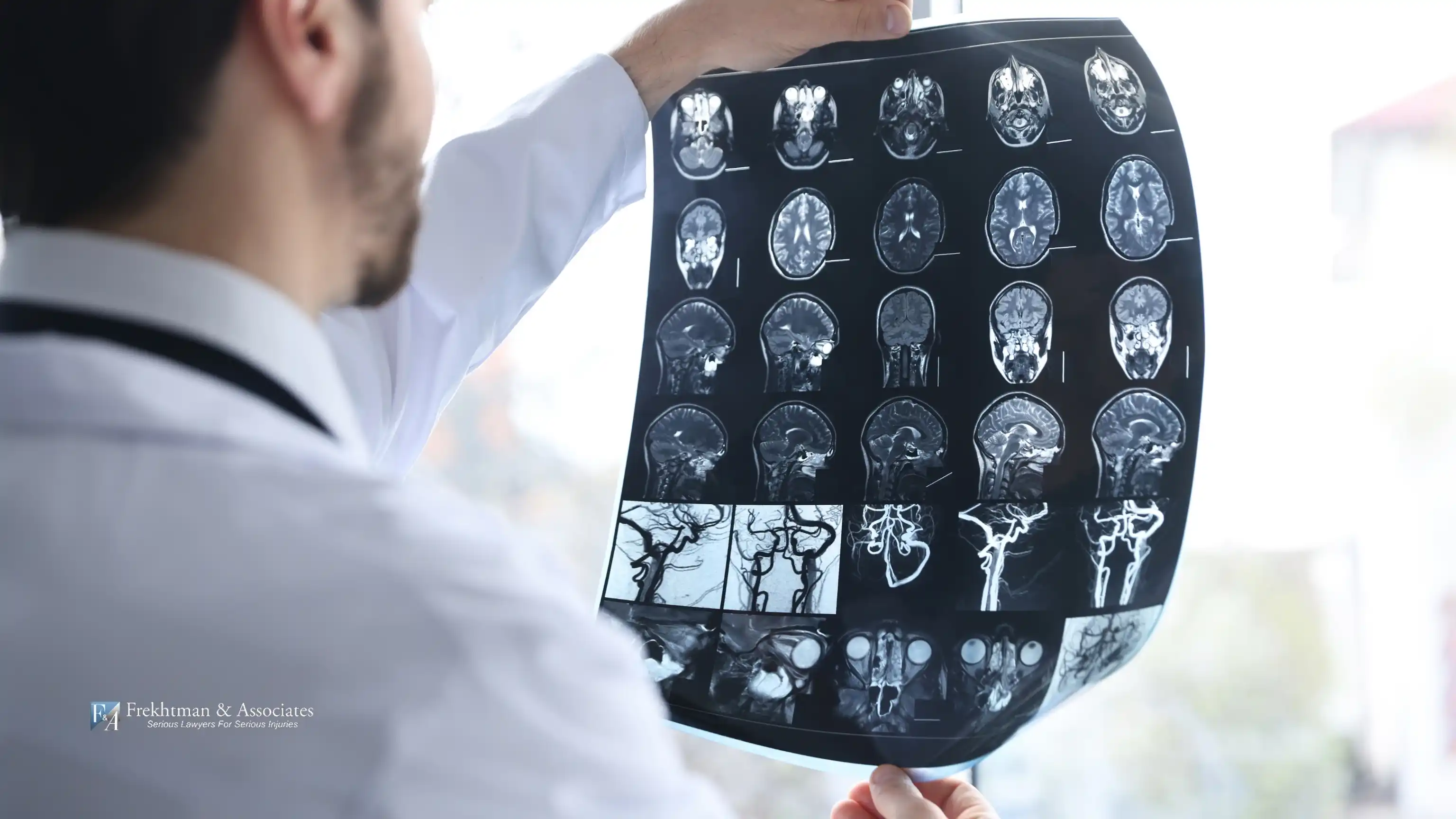 doctor reviewing brain injury report